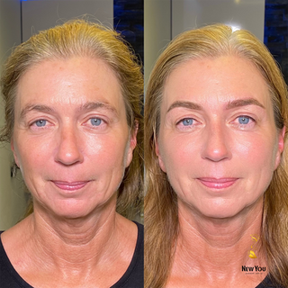 Voor en na resultaat van PowderBrows wenkbrauwen behandeling