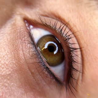 Voor en na resultaat eyeliner behandeling