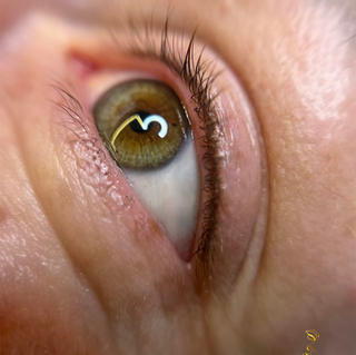 Voor en na resultaat eyeliner behandeling